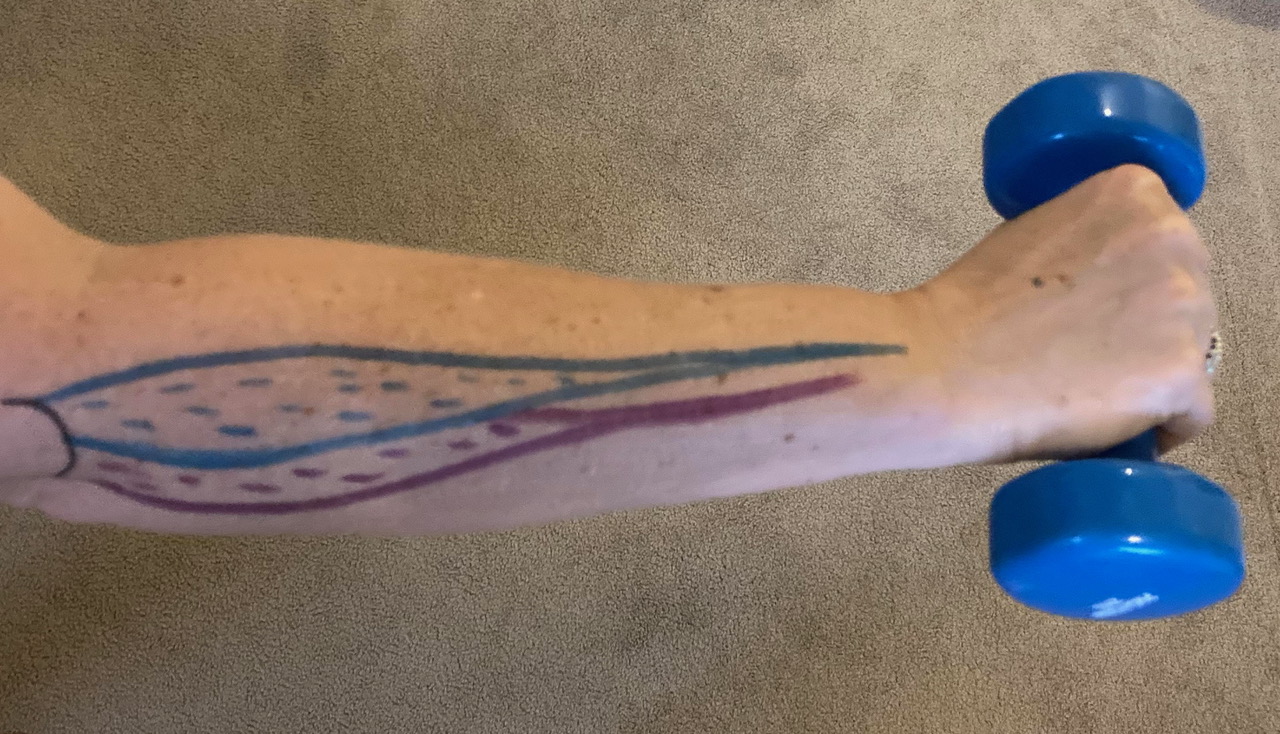 Power grip requires wrist extension of 20 degrees